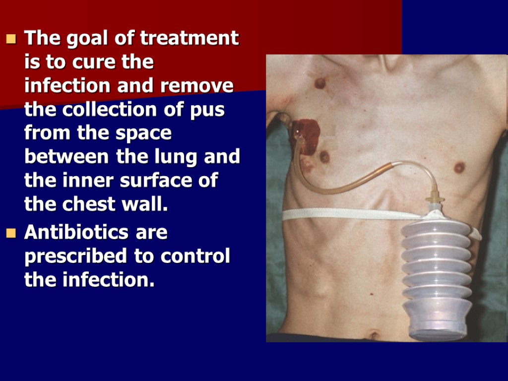The goal of treatment is to cure the infection and remove the collection of